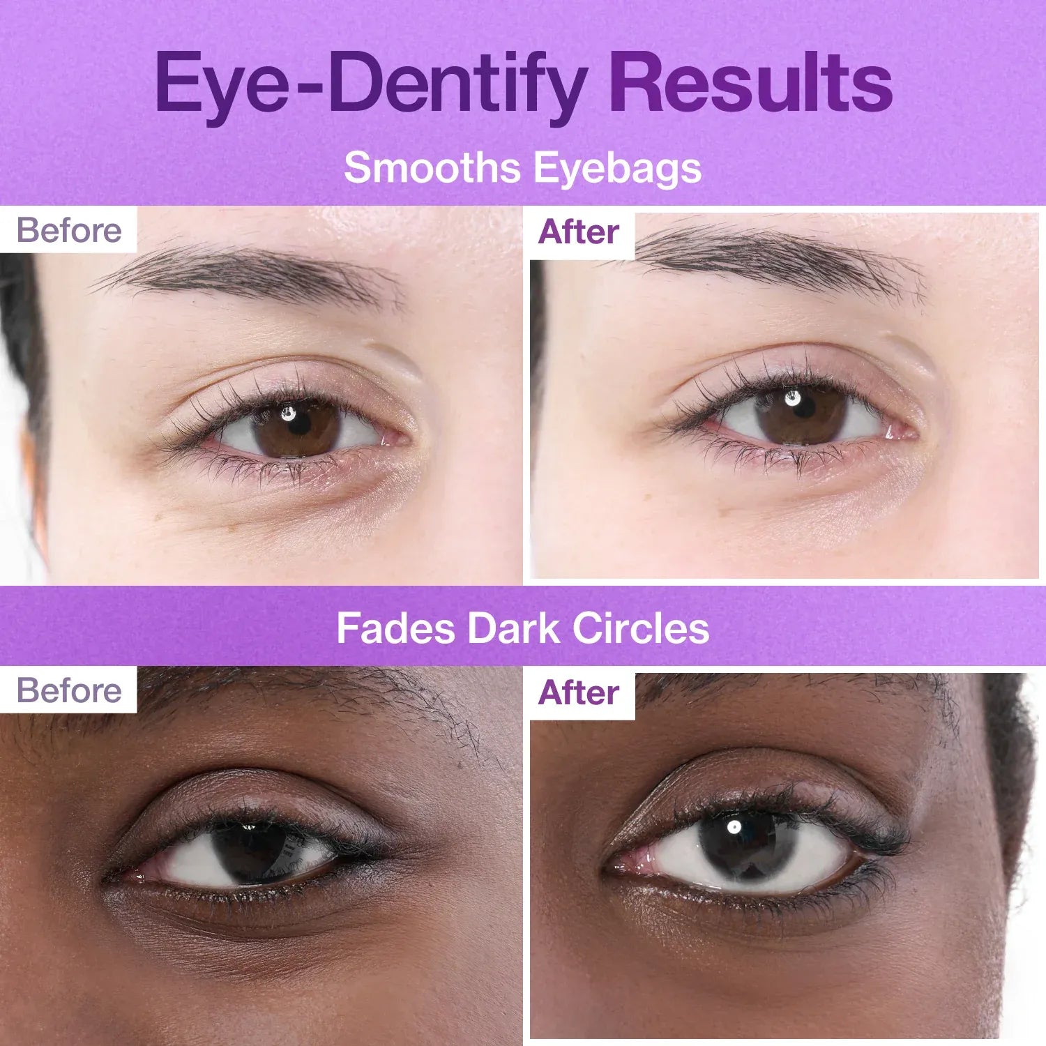 رقم 9 لصقات الكولاجين تحت العين (5 أزواج)